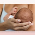 Can Nursing Mothers Get Laser Hair Removal Safely?